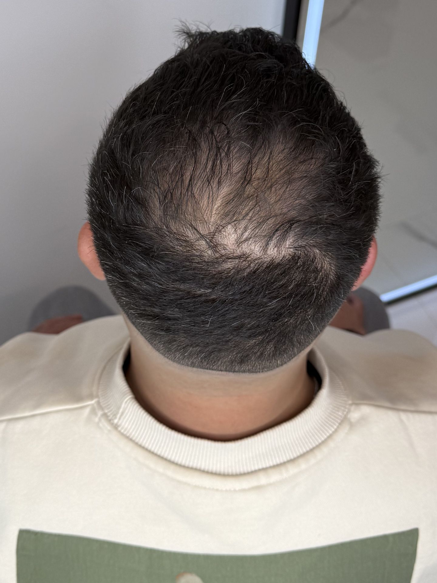 Antes del tratamiento - Efecto Densidad